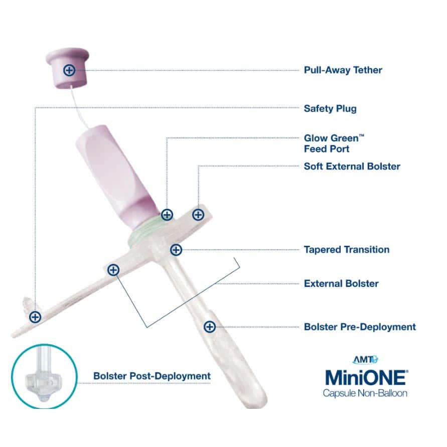 AMT Mini ONE Capsule Enfit Non-Balloon Button Feeding Device - Image 2