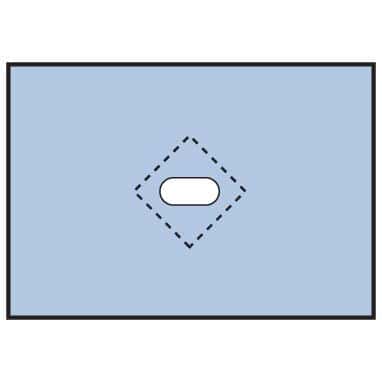 Medline Nonsterile Minor Procedure Drape - Image 1