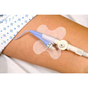 Cath-Secure Plus Tube Holder, 2-1/2 Inch, Butterfly Base - Image 1