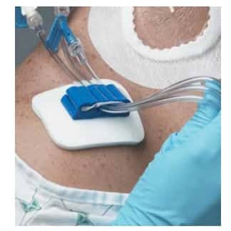 Centurion Tubing Anchor Securement Device - Image 2