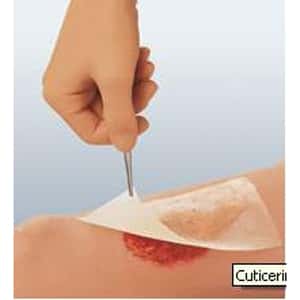 Smith & Nephew Cuticerin Oil Emulsion Impregnated Dressing - Image 3