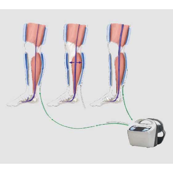 Covidien SCD Express Sleeves - Image 3