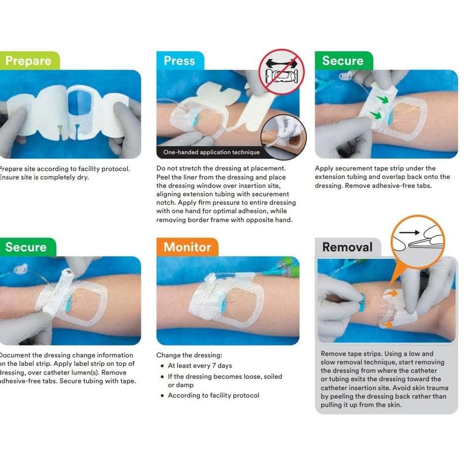 3M Tegaderm I.V. Advanced Securement Dressing - Image 4