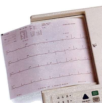 Welch Allyn Diagnostic Recording Paper Z-Fold, 8-1/2 x 11 Inch - Package of 150 - Image 1