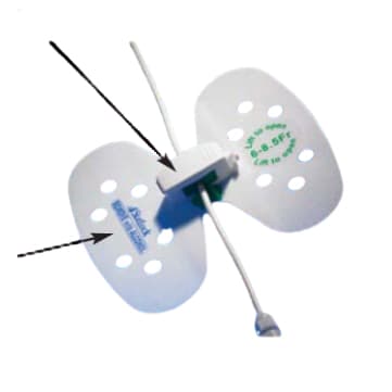 StatLock Universal Plus Stabilization Device, Small, 6 Fr to 8.5 Fr - Each - Image 1