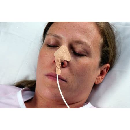 Dale Nasogastric Tube Holder - Box of 50 - Image 1