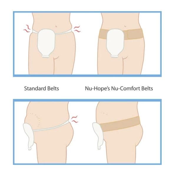 Nu-Comfort Ostomy and Hernia Support Belt - Image 8