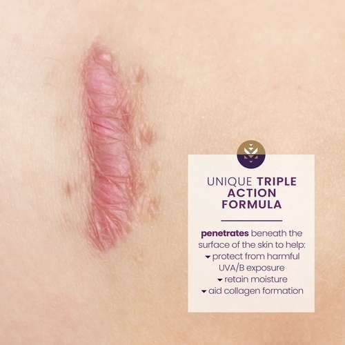 Mederma Scar Cream + SPF30 Scar Treatment with Sunscreen Cream, 20 Gram - Image 3