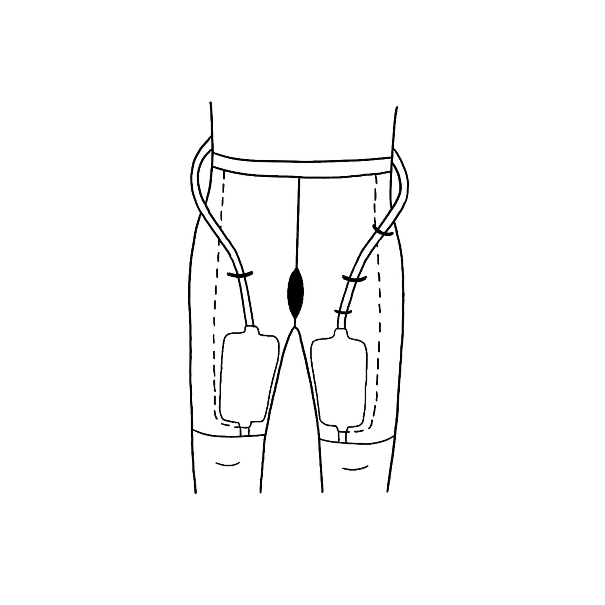 Uro Urinary Suspensory System - Image 3