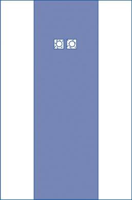 Medline Sterile Femoral Angiography Surgical Drape, with 2 Windows, 80 x 135 Inch - Image 1