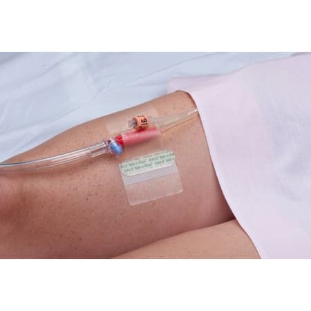 Dale Hold-n-Place Catheter Holder for Foley Catheter - Box of 50 - Image 1