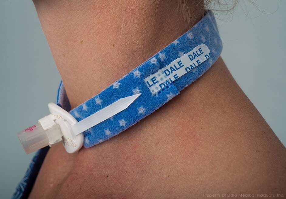 Dale Tracheostomy Tube Holders - Image 2