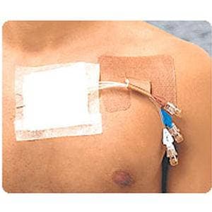 Cath Strip Multi-Use Reclosable Catheter Fastener, Latex-Free - Box of 50 - Image 1