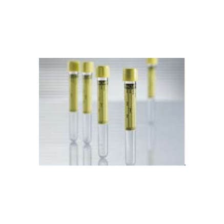 Vacuette Urinalysis Tube Plain Sterile Clear Tube, Screw Cap, 13 x 100 mm, 6.5 mL - Box of 50 - Image 1