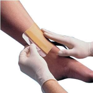 Replicare Hydrocolloid Wound Dressing - Image 2