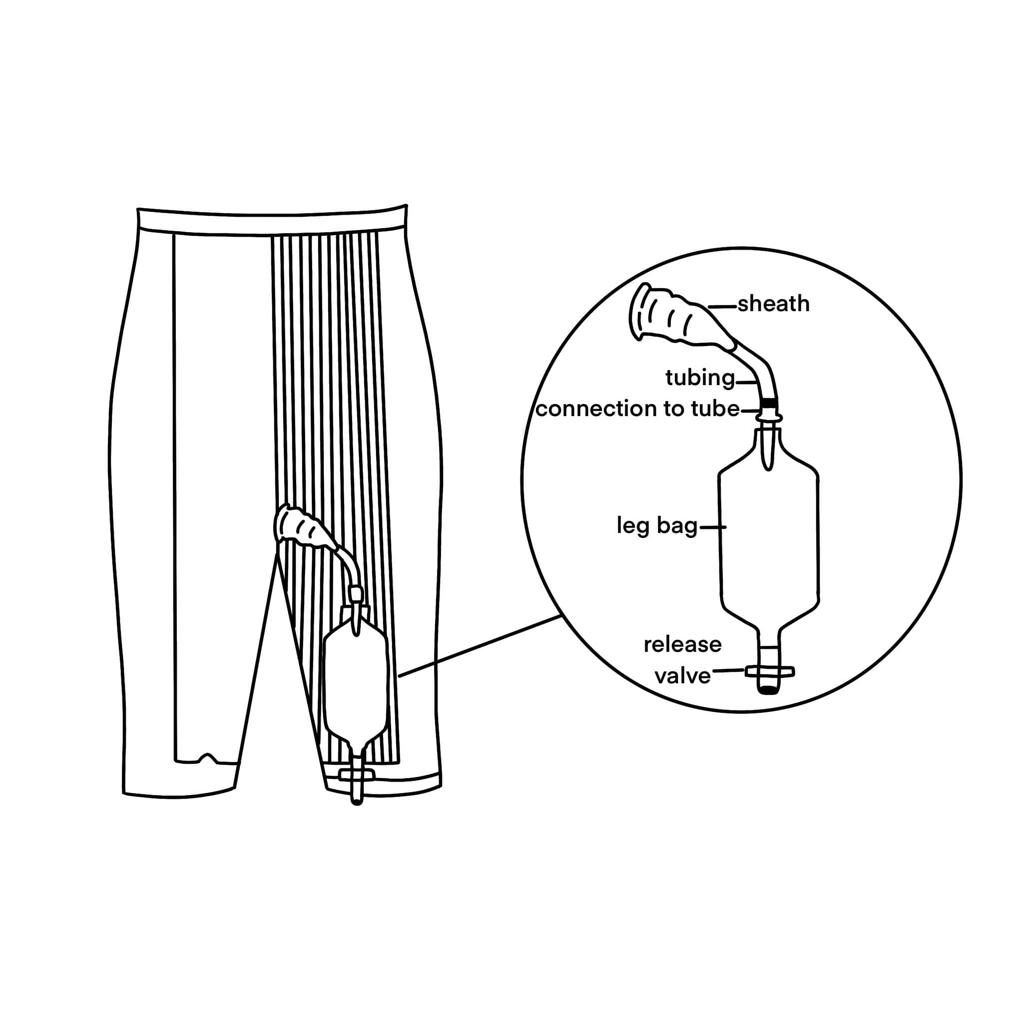 Uro Urinary Suspensory System - Image 2