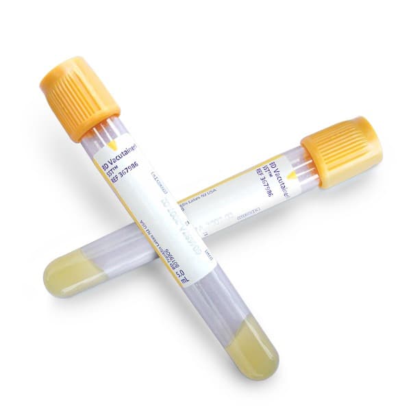 BD Vacutainer SST Venous Blood Collection Tube with Hemogard Closure, 5 ML - Case of 1000 - Image 2