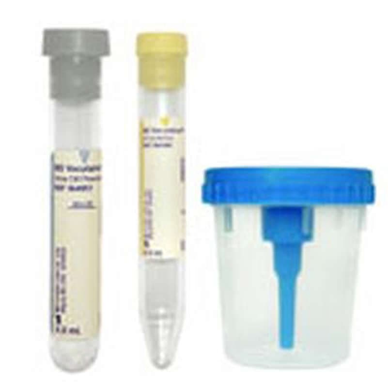 BD Vacutainer Urine Specimen Collection Kit, Sterile - Case of 50 - Image 1