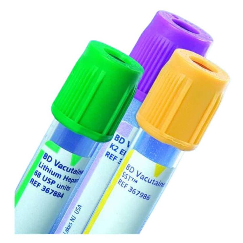 BD Vacutainer Venous Blood Collection Tube, 13 x 75 mm, 2 mL - Box of 100 - Image 1