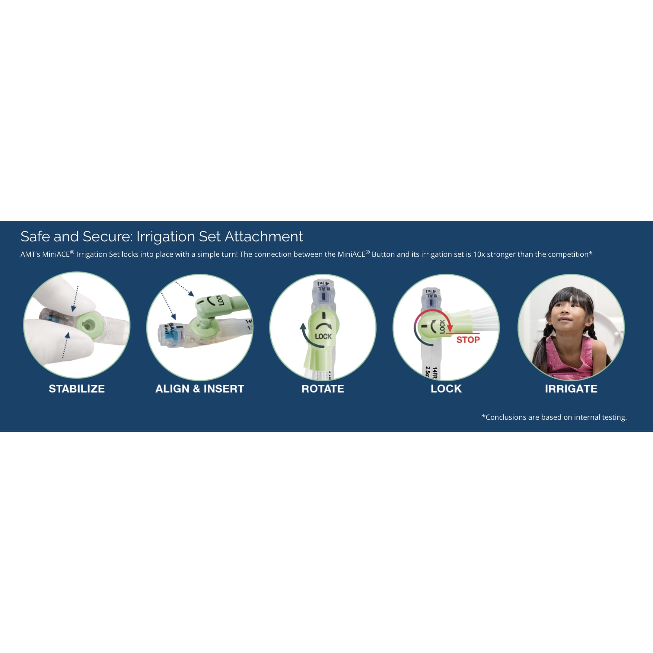 MiniACE Right Angle Single ENFit Irrigation Set with Cap - Image 2