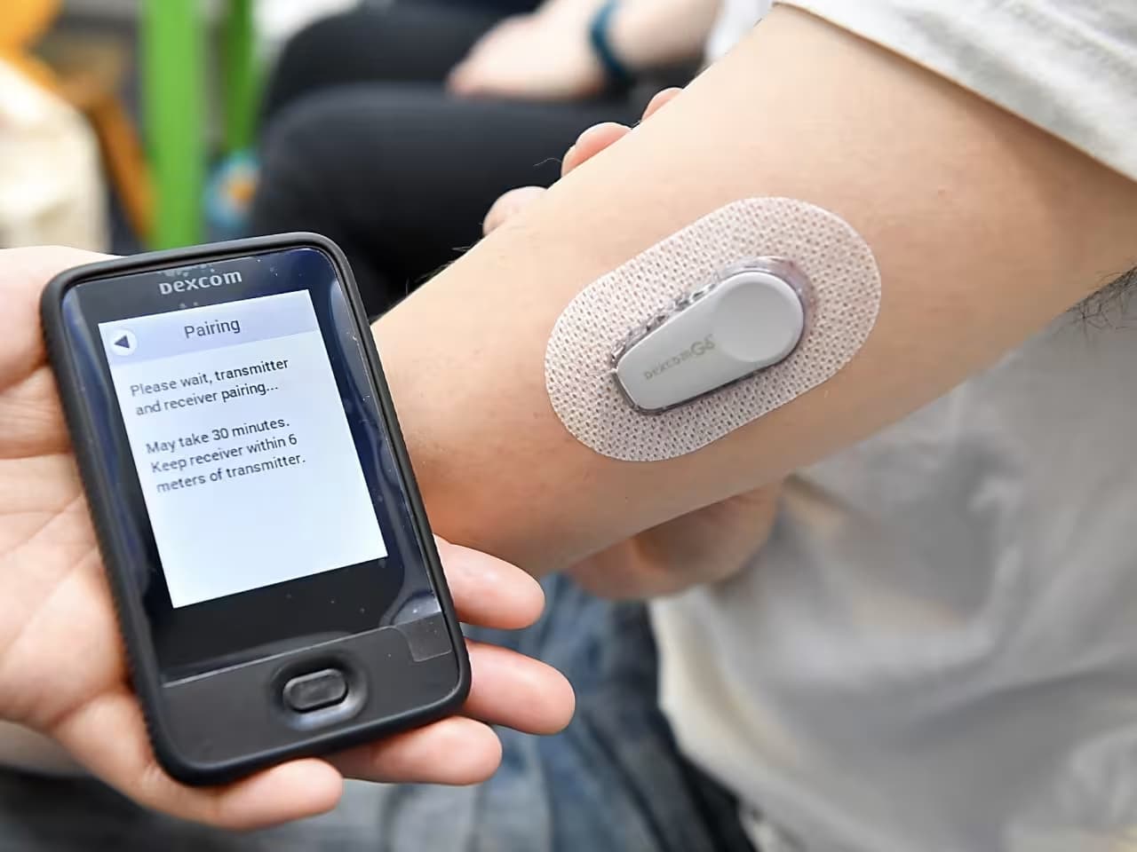 Continuous Glucose Monitoring
