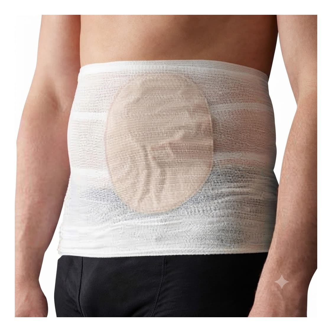 Tytex CareFix StomaSafe Classic Ostomy Support Garment, Medium - Package of 3 - Image 1