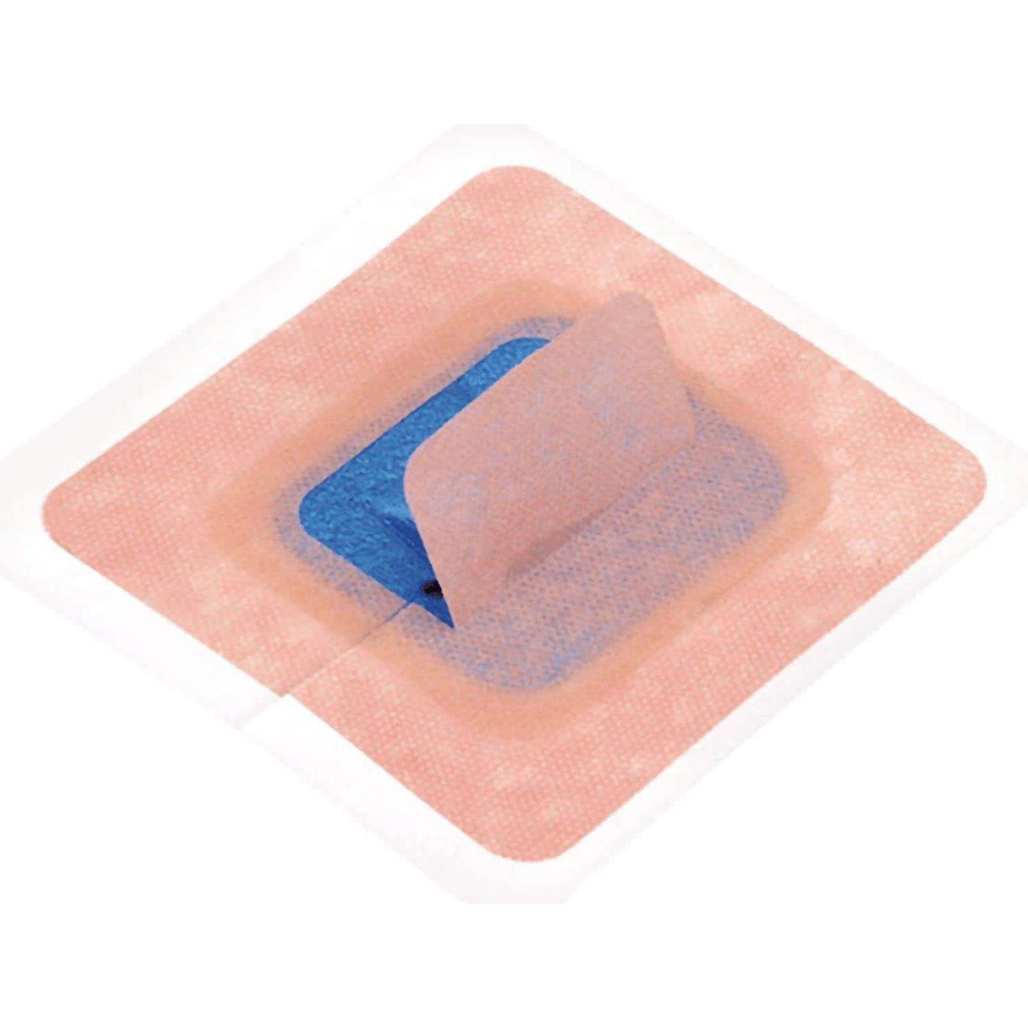 StayFIX Fixation Device for Percutaneous Catheters