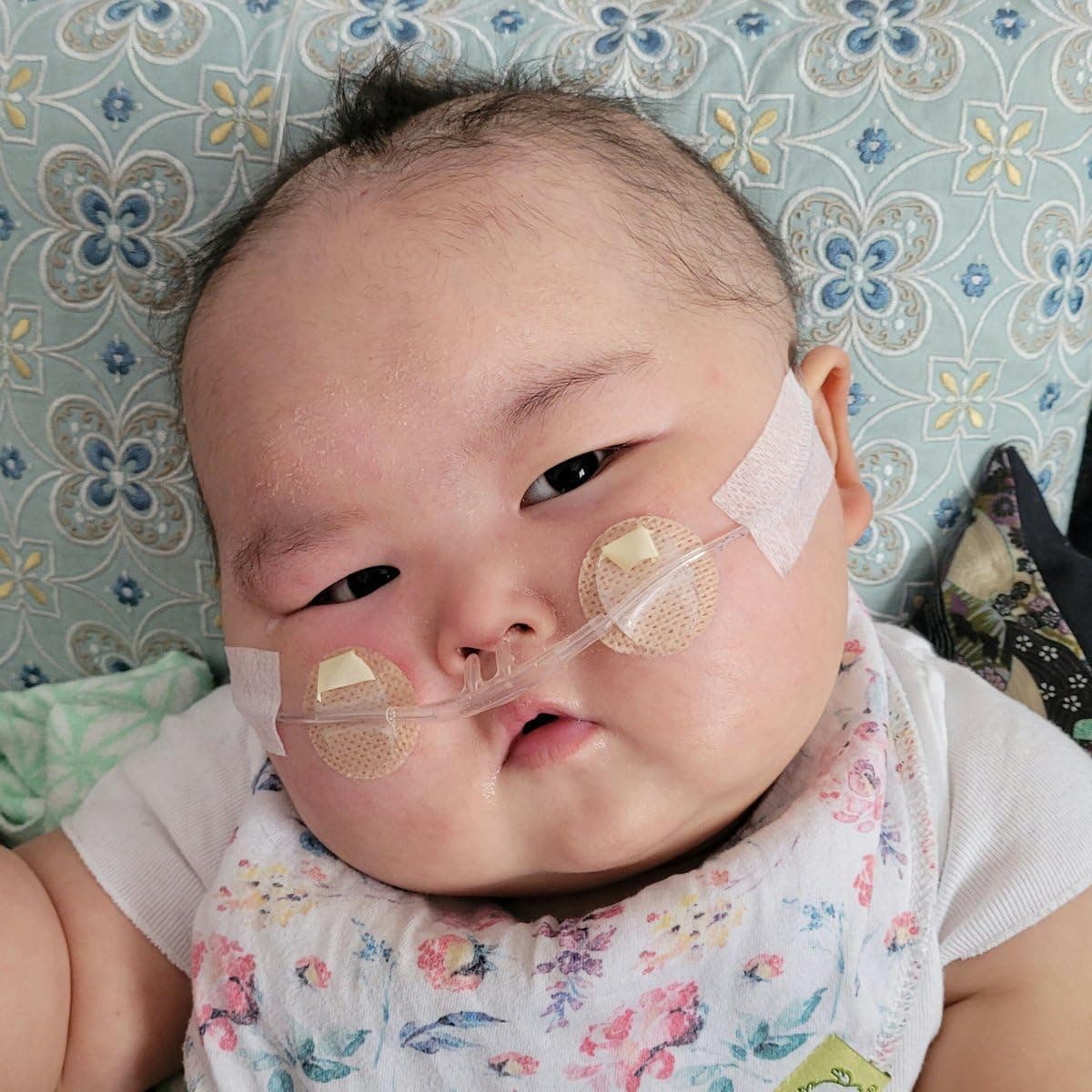 Tender Grips Securement for Cannulas - Image 3