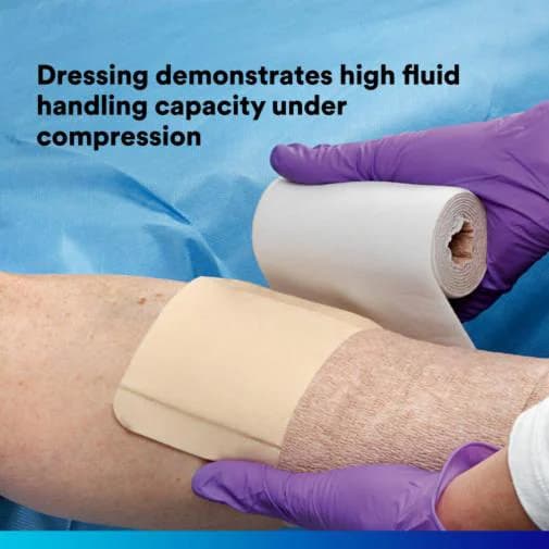 3M Tegaderm High Performance Non-Adhesive Foam Dressing - Image 6