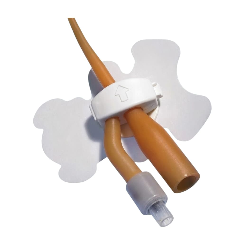 StatLock Foley Stabilization Device with Foam Anchor Pad - Box of 25 - Image 1