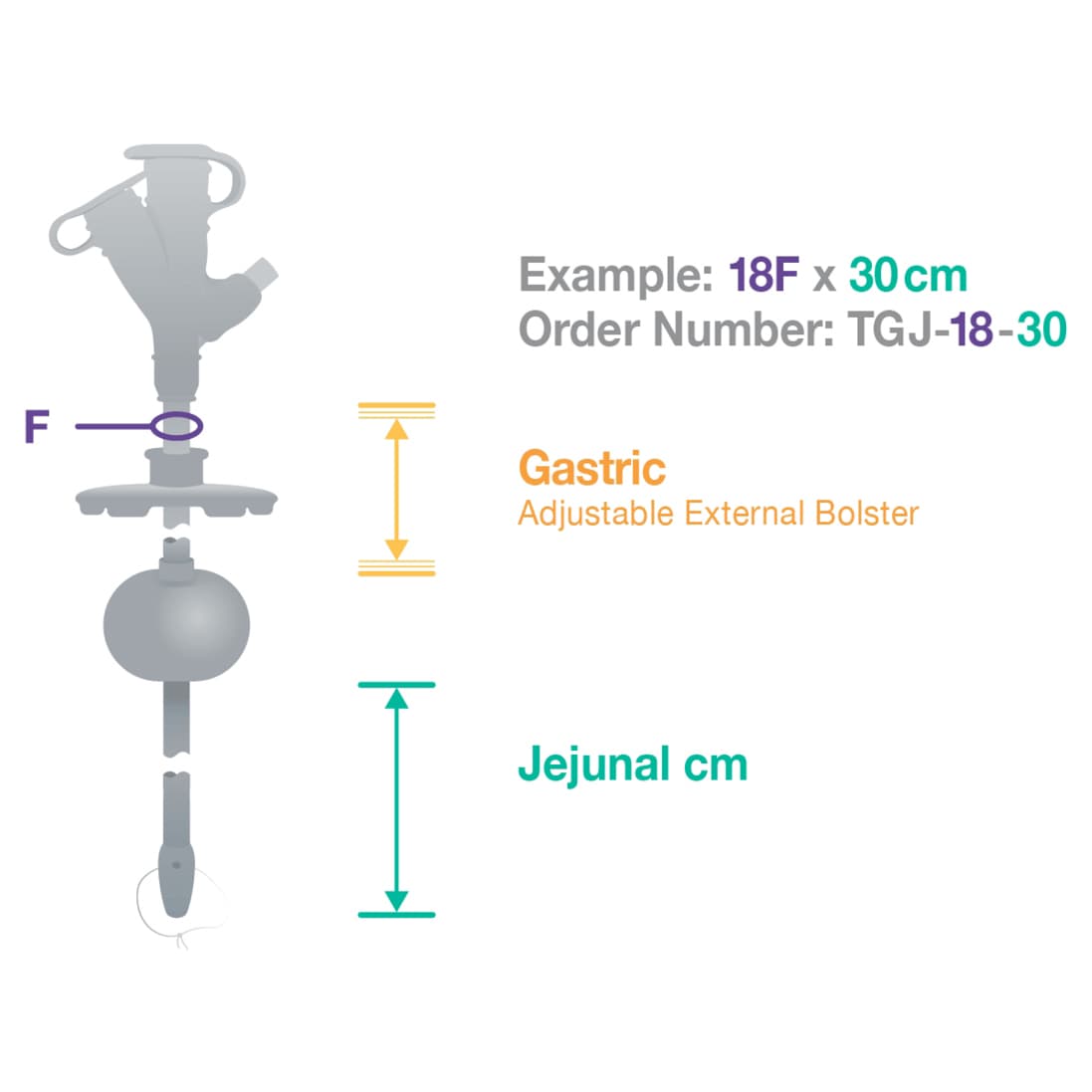 AMT Traditional G-JET Gastric Jejunal Feeding Tube Kit - Image 3