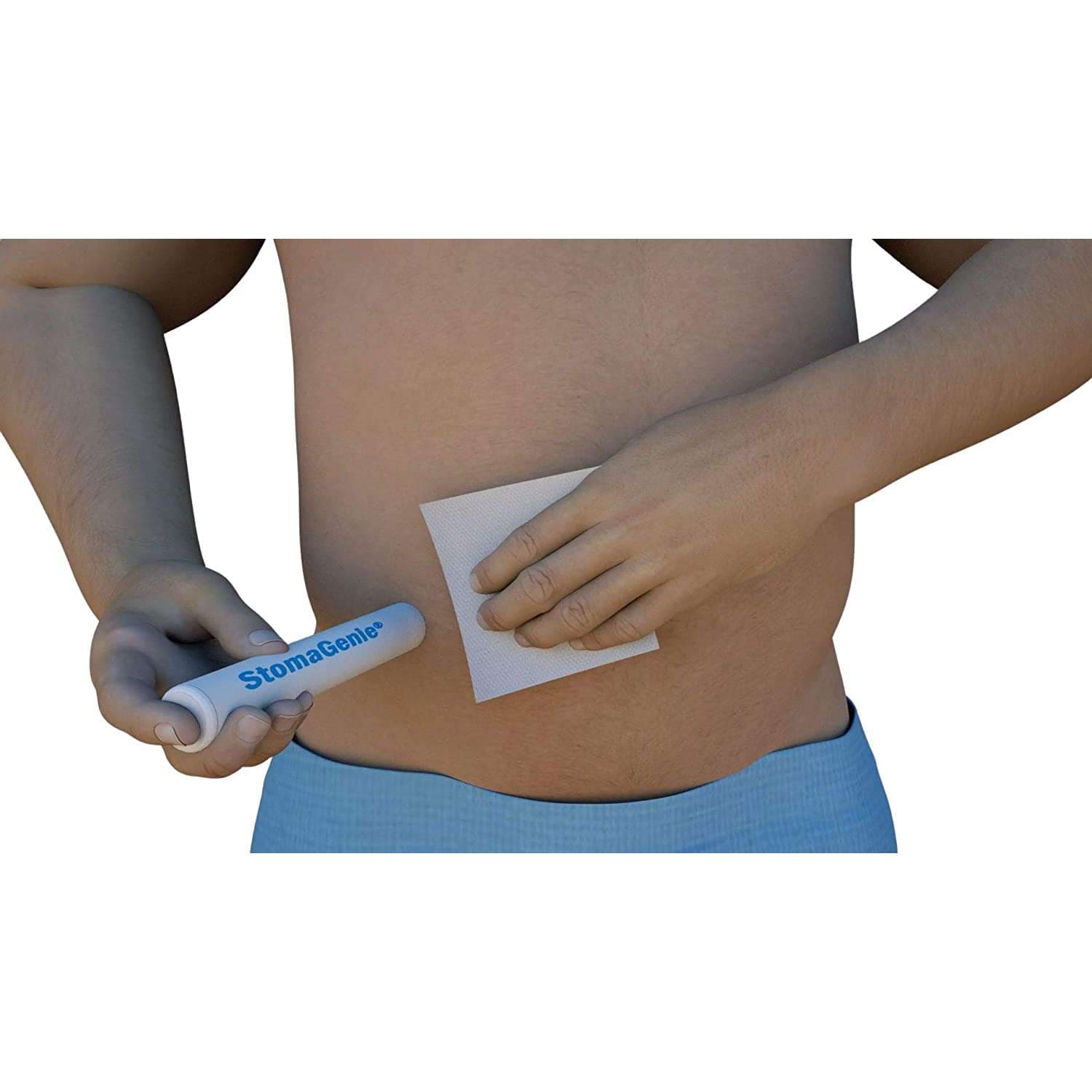 StomaGenie Capture Cartridge, 1/2" (12mm) Inside Diameter - Package of 10 - Image 1