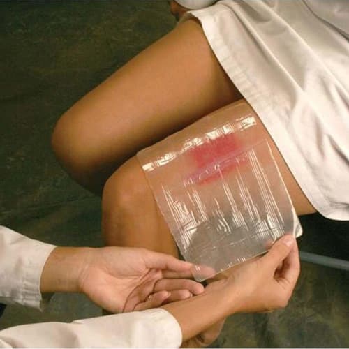 CoolMagic Hydrogel Dressing Translucent, 8 x 12 Inch - Each - Image 1