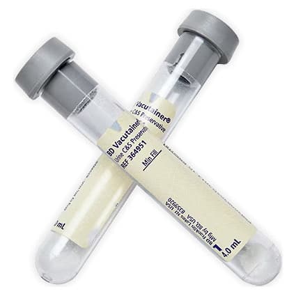BD Vacutainer Plus C&S Preservative Urinalysis Tube with Boric Acid, Sodium Formate, Sodium Borate Additive