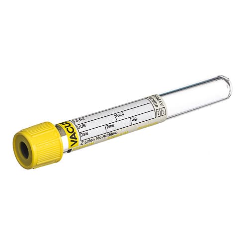 Vacuette Urinalysis Tube Plain Sterile Clear Tube, Screw Cap, 13 x 100 mm, 6.5 mL - Box of 50 - Image 1