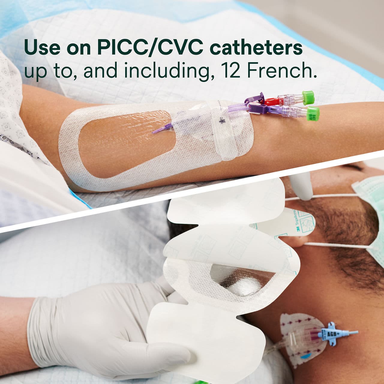 3M PICC / CVC Securement Device + Tegaderm I.V. Advanced Securement Dressing 3M PICC / CVC Securement Device + Tegaderm I.V. Advanced Securement Dressing