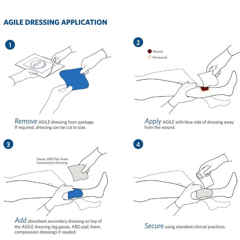 Milliken Agile Fibril Dressing with AFM Technology - Image 3