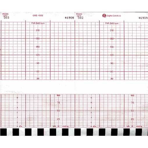 Corometrics Fetal Monitor ECG Chart Paper - Case of 40 - Image 1