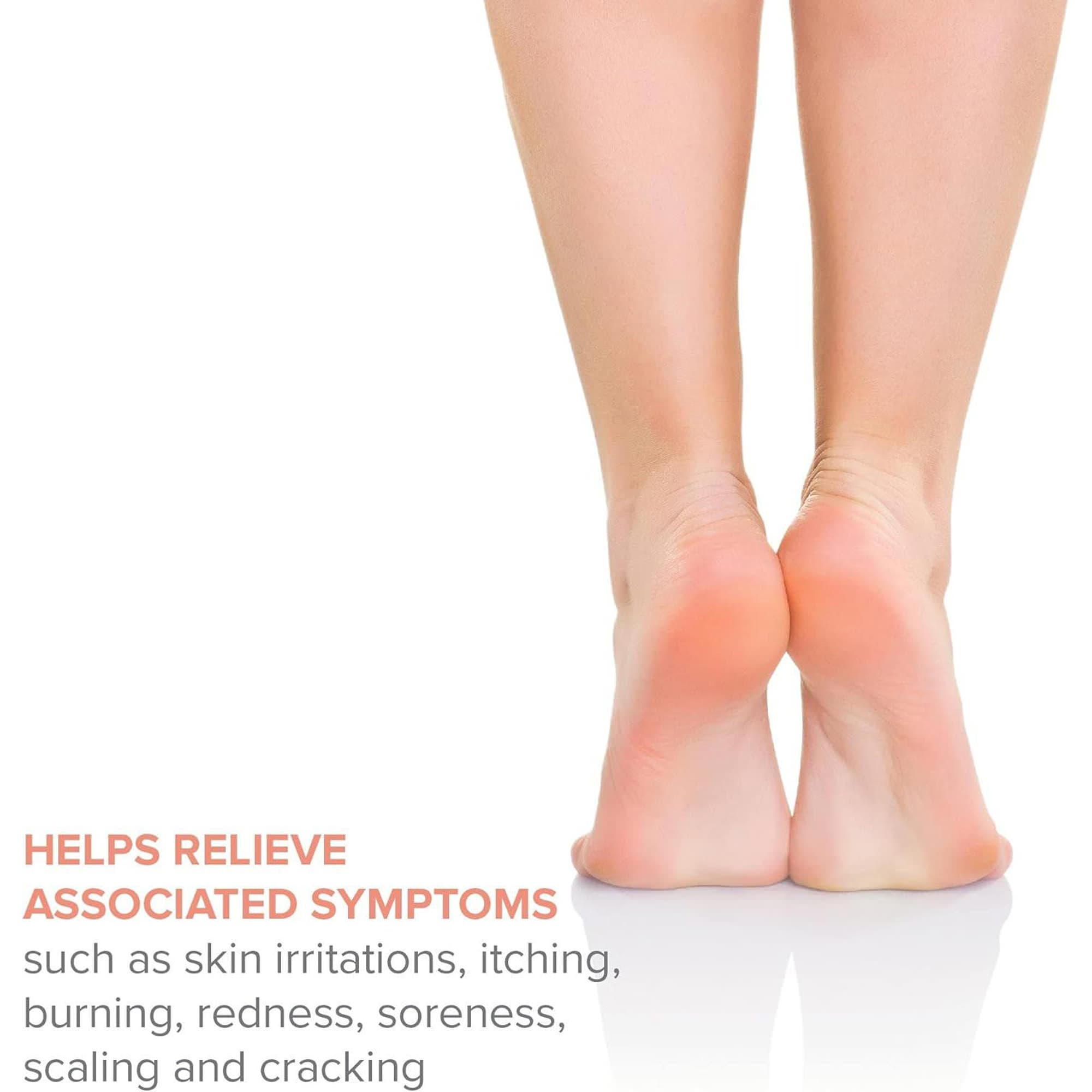 McKesson Thera Antifungal Body Powder, 3 oz - Image 4