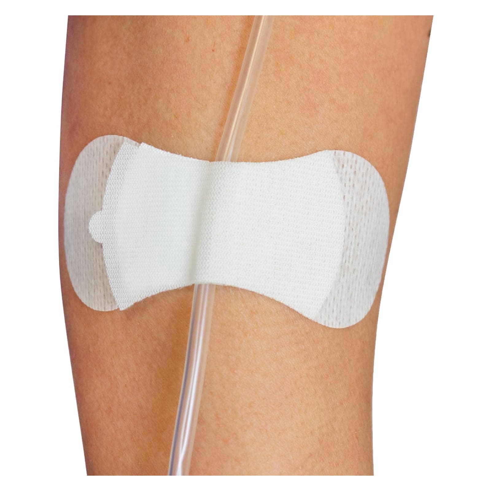 Grip-Lok General Securement Device for Universal Catheter, Medium - Box of 100 - Image 1