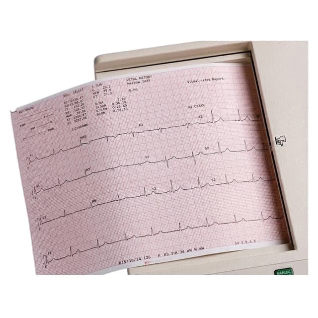 Welch Allyn Diagnostic Recording Paper Z-Fold, 8-1/2 x 11 Inch