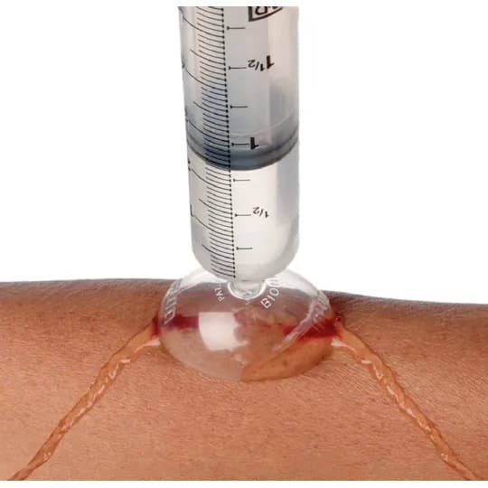 Bionix Igloo Wound Irrigation Shields - Image 4