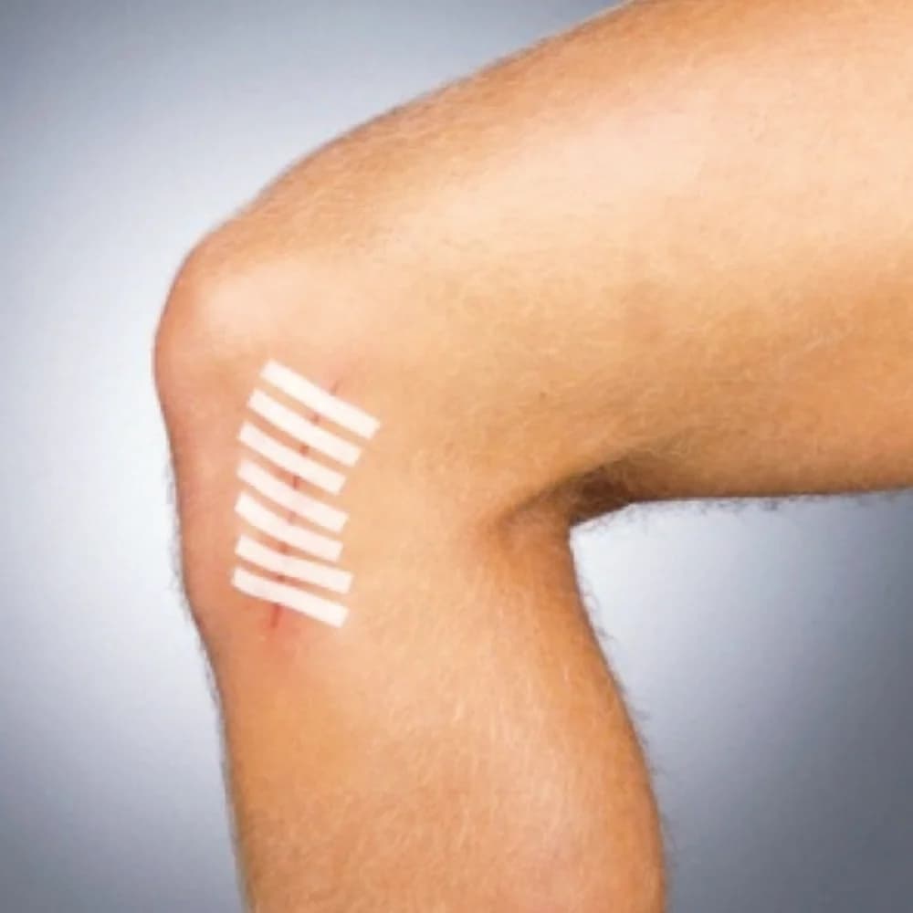 Suture Strip Plus Flexible Wound Closure Strips, Sterile - Image 4