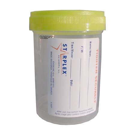 Starplex Graduated Specimen Container, OR Sterile - Image 1