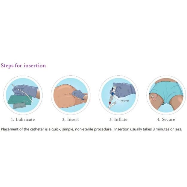 The Macy Catheter Rectal Medication Tube - Image 2