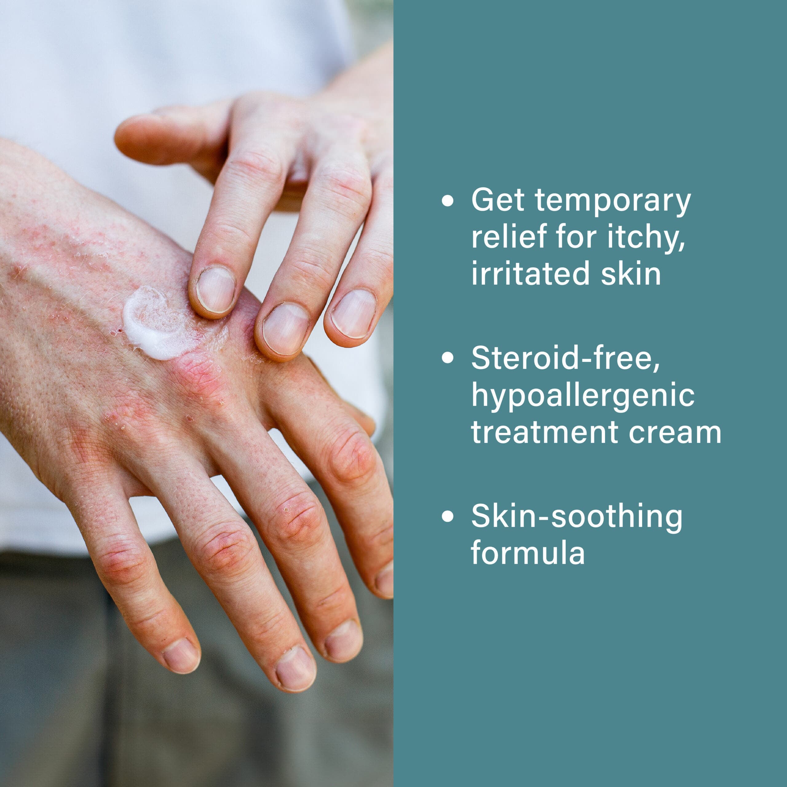 Sarna Eczema Relief Lotion Tube, 7.5 oz - Each - Image 3