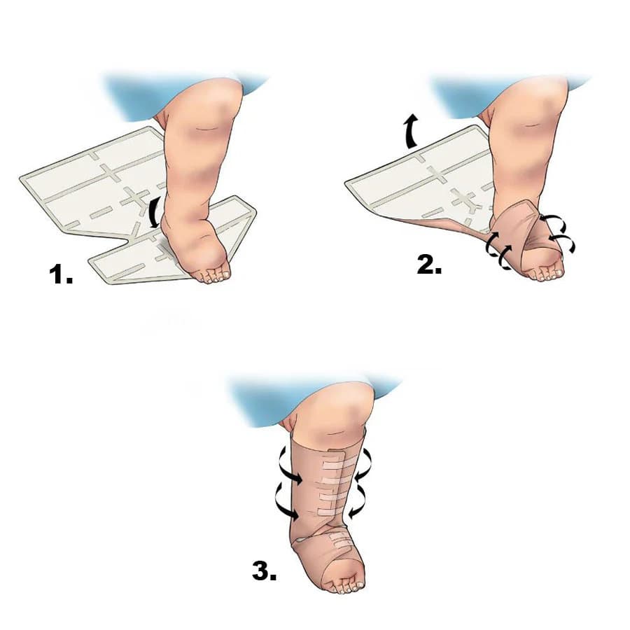 Eclypse Boot Super Absorbent Wound Dressing - Image 4