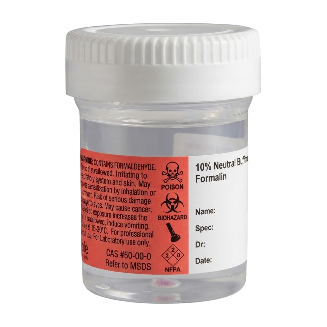 Cardinal SP Prefilled Formalin Container, 30 mL Fill in 60 mL, 2 oz with Screw Cap - Package of 50 - Image 1
