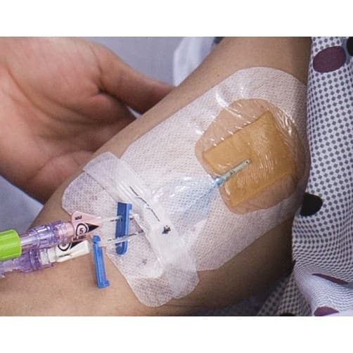 3M PICC-CVC Securement Device + Tegaderm CHG IV Dressing, 4 x 6.125 Inch - Each - Image 1