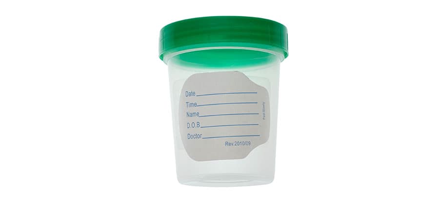 AMSure Specimen Container, 4 oz - Case of 100 - Image 1